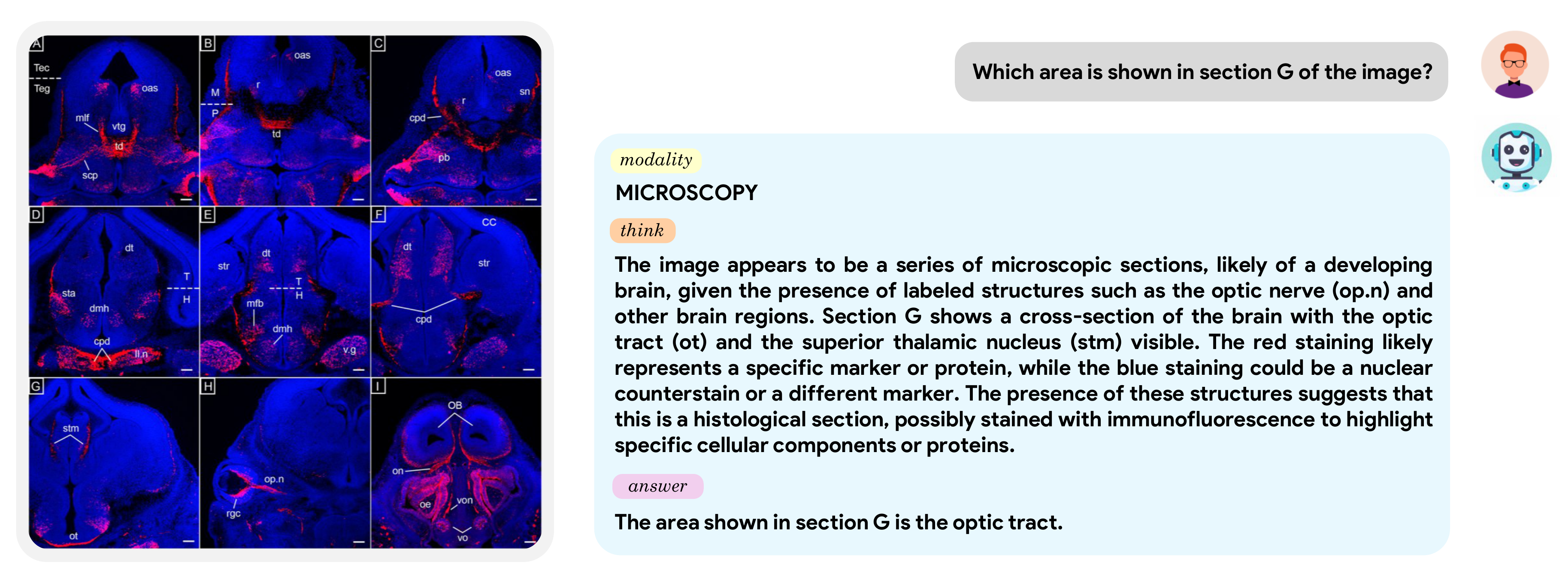 Microscopy Example